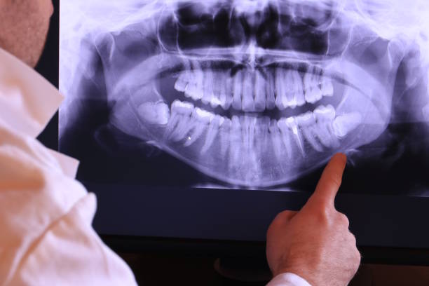 Best Emergency Dental Services for Seniors in Baywood Park, CA