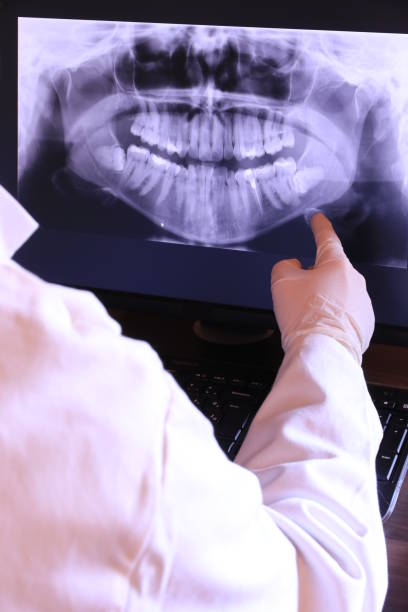 Best Emergency Dental Extractions in Baywood Park, CA