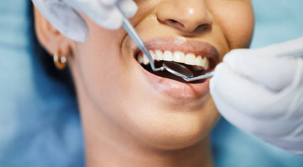 Best Emergency Root Canal Treatment in Baywood Park, CA